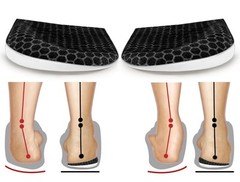 Corrective Insoles for Supination & Over-Pronation, Orthotics Medial & Latera…